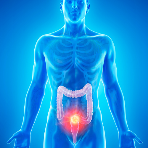 1  | 3 | 7 | 10 Day Coconut Water Fast + Cleanse Guide